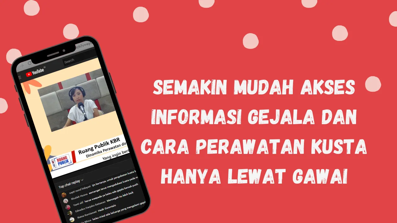 Semakin mudah akses informasi Gejala dan cara perawatan kusta hanya lewat gawai